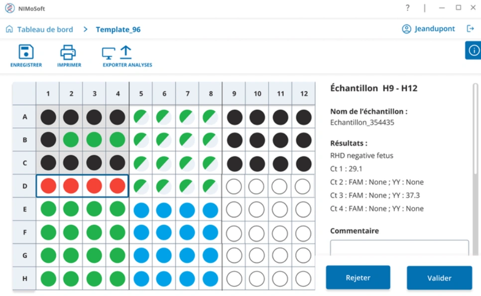 Flujo de trabajo de NIMoTest Fetal RHD qPCR kit